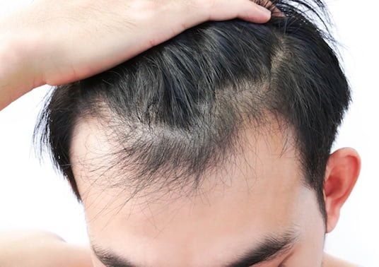 7 Rekomendasi Hair Care Pria yang Rambutnya Mulai Menipis