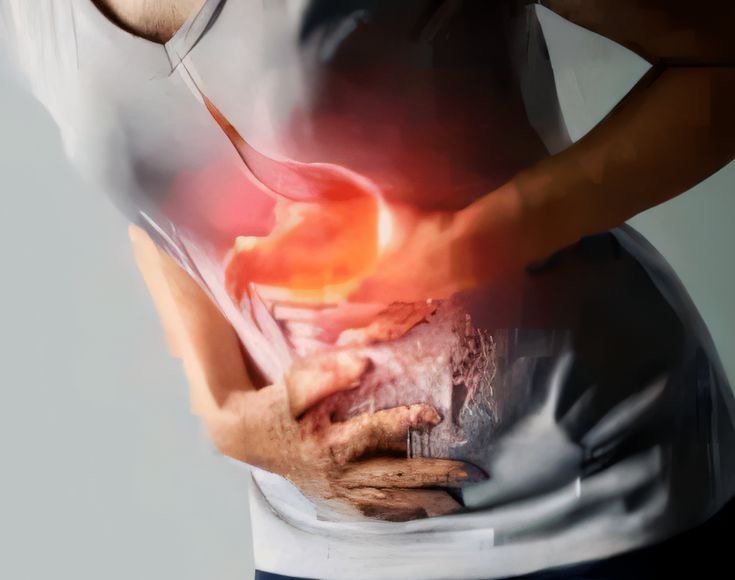 Asam Lambung Naik Saat Puasa Ramadan? Ini Penjelasan dan Tips Agar Ibadah Tetap Nyaman