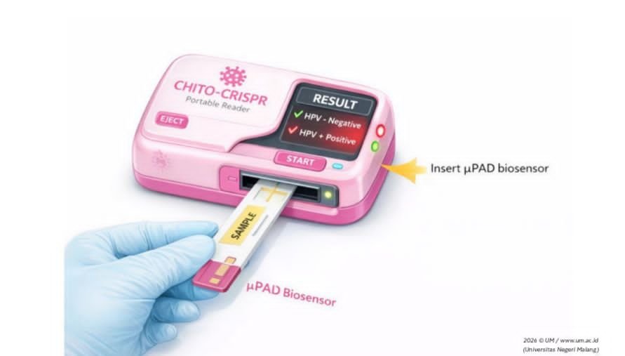 Mahasiswa FK UM Ciptakan Alat Deteksi Kanker Serviks dan Autoimun, Raih Prestasi Nasional